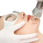 لیزر CO2 فرکشنال