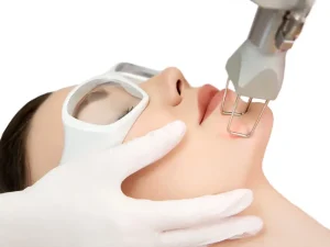 لیزر CO2 فرکشنال