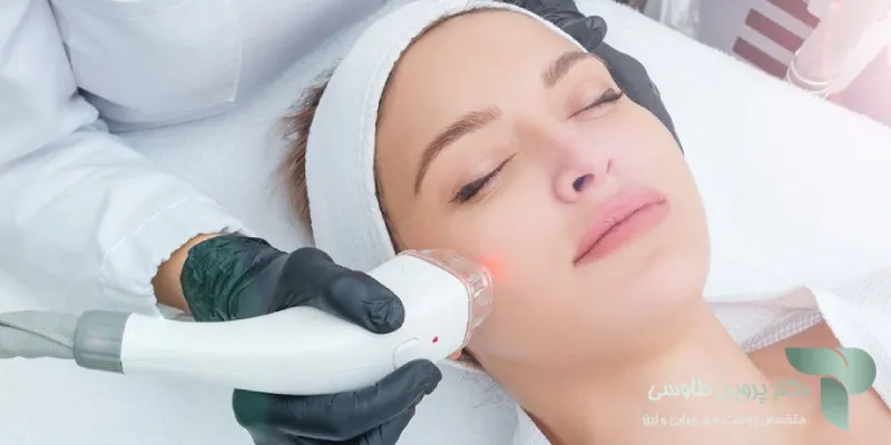 مزایا لیزر co2 فرکشنال