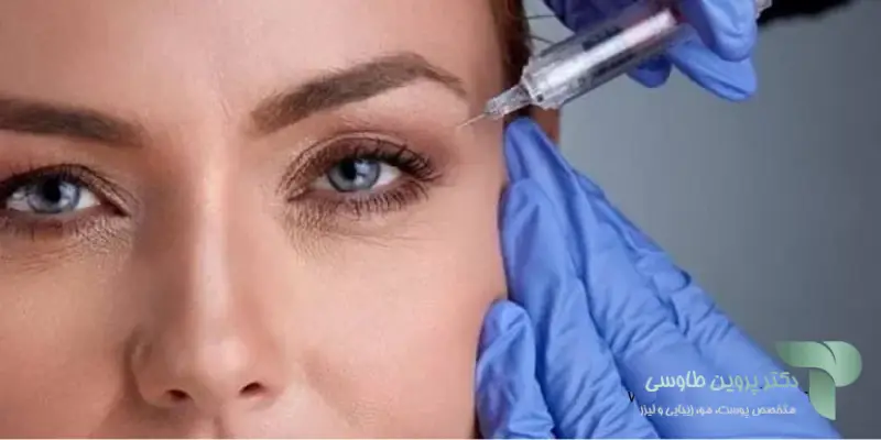 نقاط تزریق بوتاکس کدام نواحی است؟
