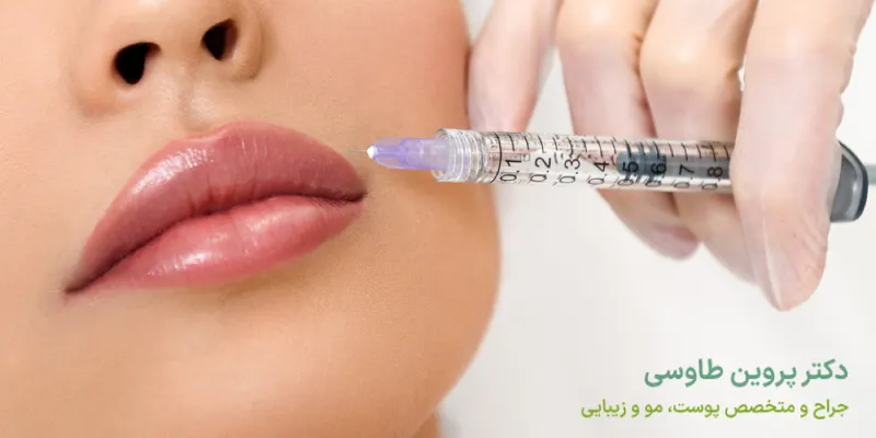 چگونگی تزریق فیلر