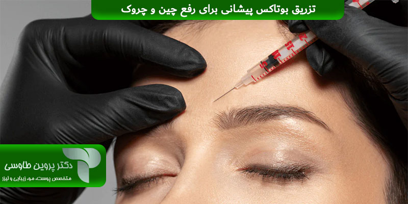 تزریق بوتاکس پیشانی برای رفع چین و چروک 