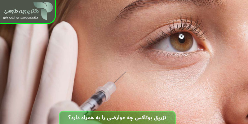 تزریق بوتاکس چه عوارضی را به همراه دارد؟