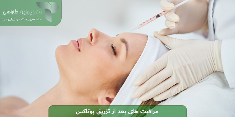 مراقبت های بعد از تزریق بوتاکس