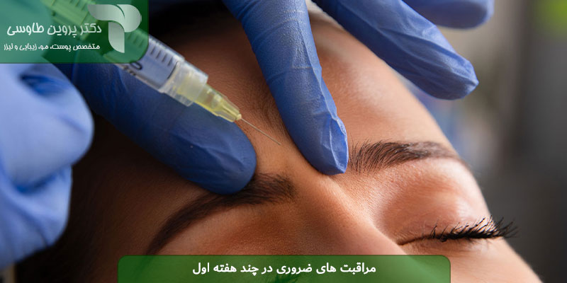 مراقبت های ضروری در چند هفته اول