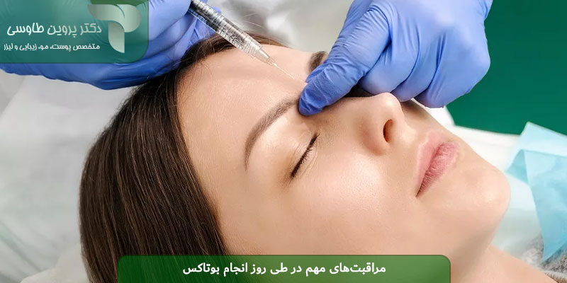 مراقبت‌های مهم در طی روز انجام بوتاکس