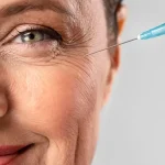تزریق بوتاکس زیر چشم