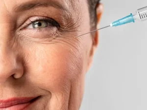 تزریق بوتاکس زیر چشم