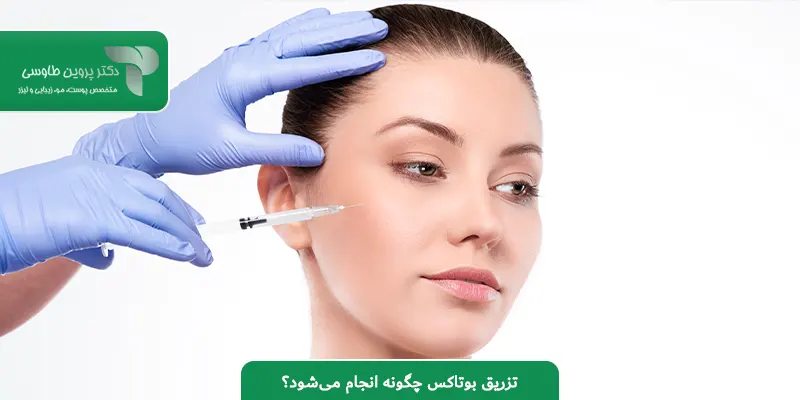 تزریق بوتاکس چگونه انجام می‌شود؟