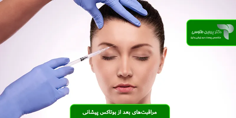 مراقبت‌های بعد از بوتاکس پیشانی 