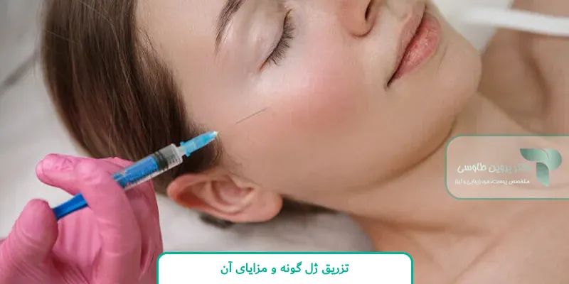 تزریق ژل گونه و مزایای آن
