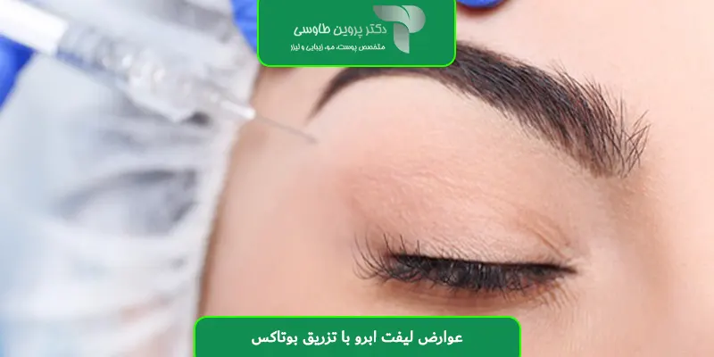 عوارض لیفت ابرو با تزریق بوتاکس