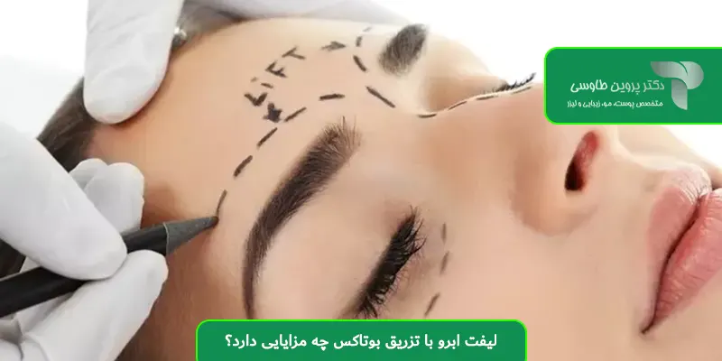 لیفت ابرو با تزریق بوتاکس چه مزایایی دارد؟