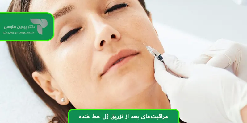مراقبت‌های بعد از تزریق ژل خط خنده