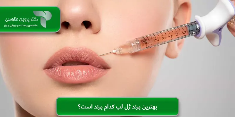 بهترین برند ژل لب کدام برند است؟