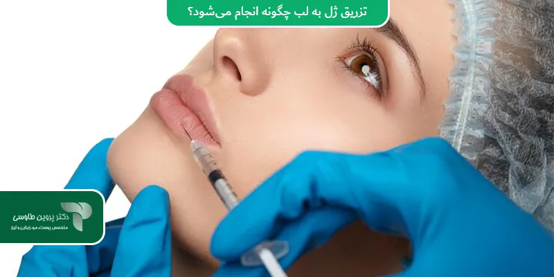 تزریق ژل به لب چگونه انجام می‌شود؟