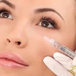 تزریق ژل زیر چشم