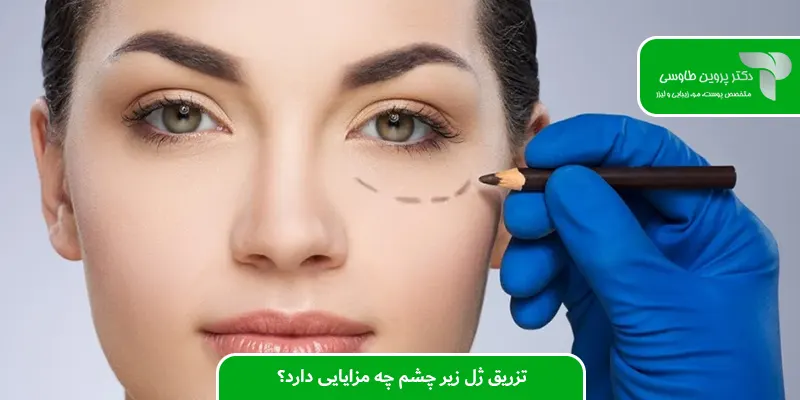 تزریق ژل زیر چشم چه مزایایی دارد؟