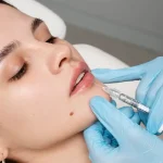 قیمت تزریق ژل