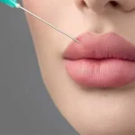 مراقبت های بعد از تزریق ژل لب