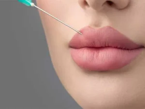 مراقبت های بعد از تزریق ژل لب