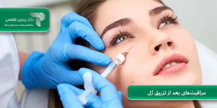 مراقبت‌های بعد از تزریق ژل
