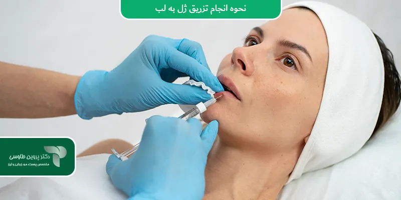 نحوه انجام تزریق ژل به لب