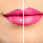انواع مدل تزریق ژل لب