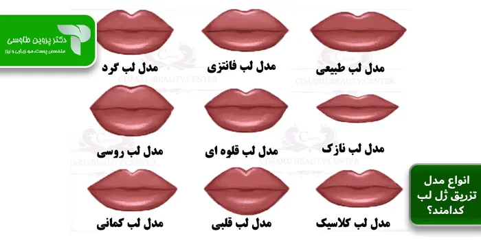 انواع مدل تزریق ژل لب کدامند