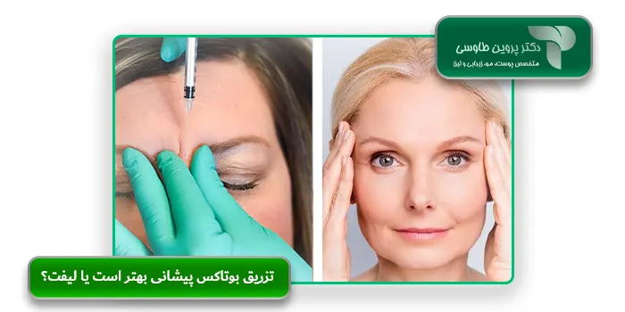 تزریق بوتاکس پیشانی بهتر است یا لیفت؟