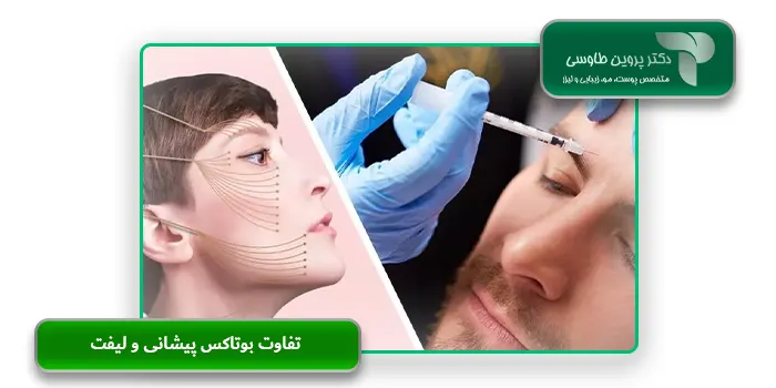 تفاوت بوتاکس پیشانی و لیفت