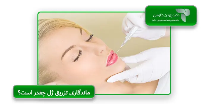 ماندگاری تزریق ژل چقدر است؟