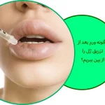 ورم بعد از تزریق ژل