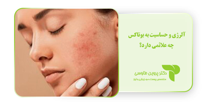 آلرژی و حساسیت به بوتاکس چه علائمی دارد؟