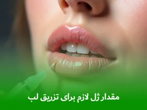 مقدار ژل لازم برای تزریق لب‌