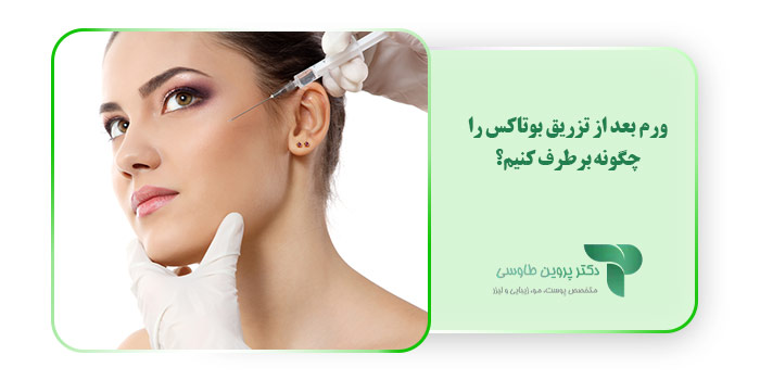 ورم بعد از تزریق بوتاکس را چگونه برطرف کنیم؟