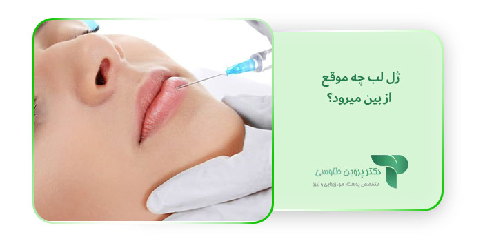 ژل لب چه موقع از بین میره؟