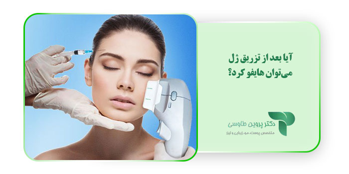 آیا بعد از تزریق ژل می‌توان هایفو کرد؟