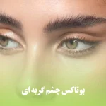بوتاکس چشم گربه ای برای بانوانی که می خواهند گوشه چشم آنها به سمت بالا کشیده شود