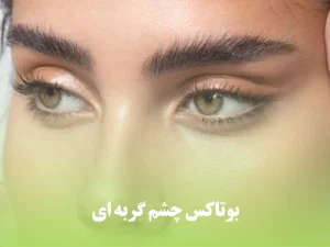 بوتاکس چشم گربه ای برای بانوانی که می خواهند گوشه چشم آنها به سمت بالا کشیده شود