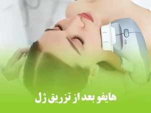 هایفو بعد از تزریق ژل