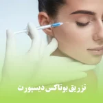 تزریق بوتاکس دیسپورت برای از بین بردن چین و چروک