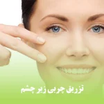 تزریق چربی زیر چشم