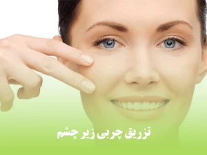 تزریق چربی زیر چشم