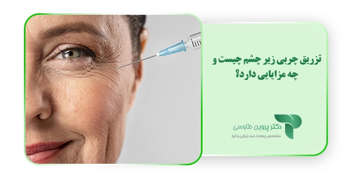 تزریق چربی زیر چشم چیست و چه مزایایی دارد؟