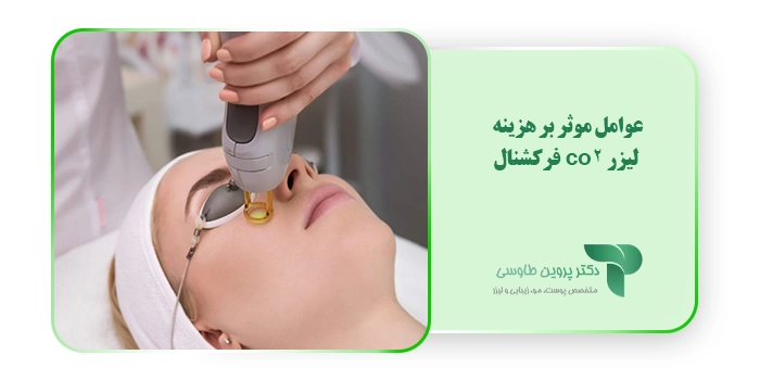 عوامل موثر بر هزینه لیزر co2 فرکشنال