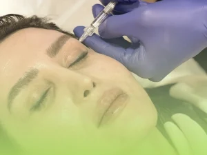 تزریق ژل به شقیقه