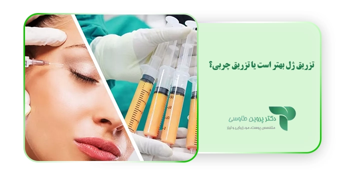 تزریق ژل بهتر است یا تزریق چربی؟