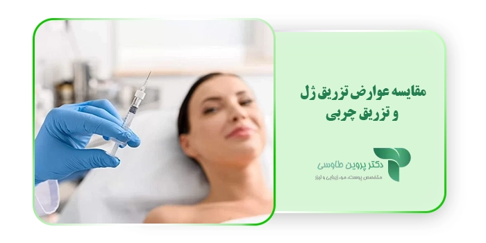 مقایسه عوارض تزریق ژل و تزریق چربی