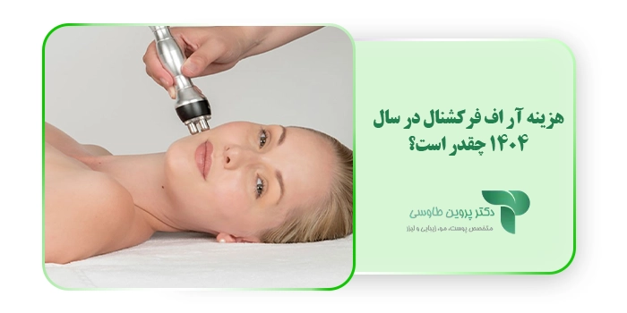 هزینه آر اف فرکشنال در سال 1403 چقدر است؟
